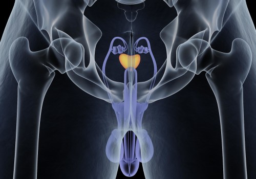 Where is the first place that prostate cancer spreads to?